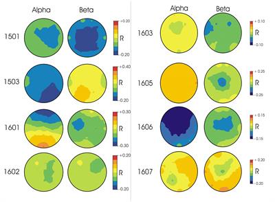 EEG Error Prediction as a Solution for Combining the Advantages of Retrieval Practice and Errorless Learning